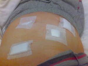 A hasam, már cső nélkül