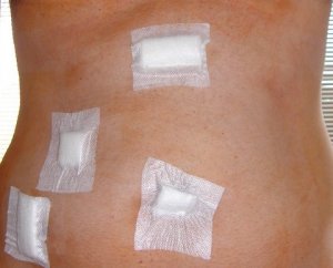 A hasam, már otthon